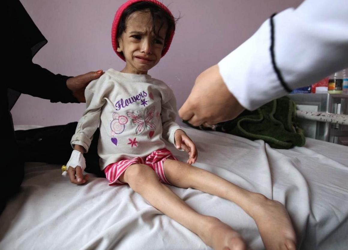 Five Million Yemeni Children may face famine