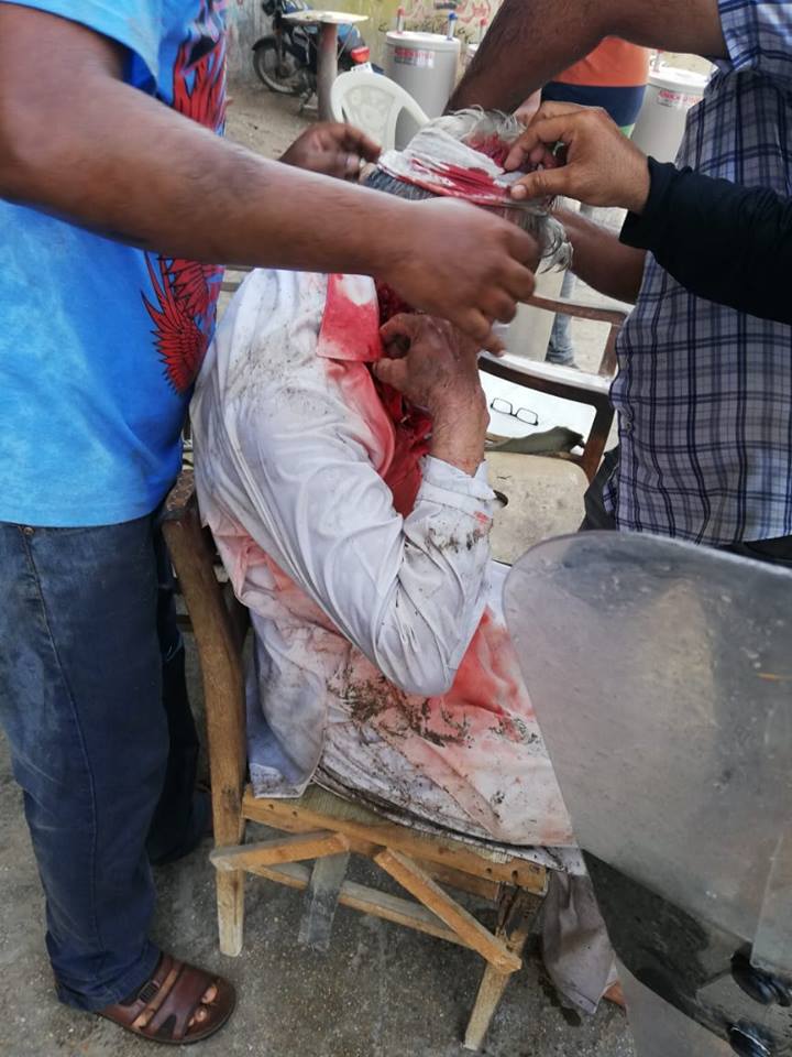 An injured Old man at Pakistan Quarters Karachi