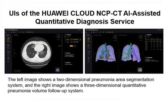 Huawei Launches New AI to Diagnose Coronavirus within seconds 