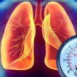 Hypertension in Pakistan
