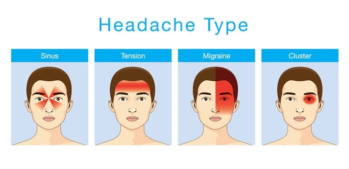 Headache relief